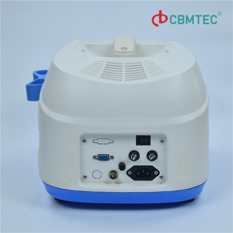 Digital Portable Ultrasonic Diagnosis Equipment Ultrasound Scanner